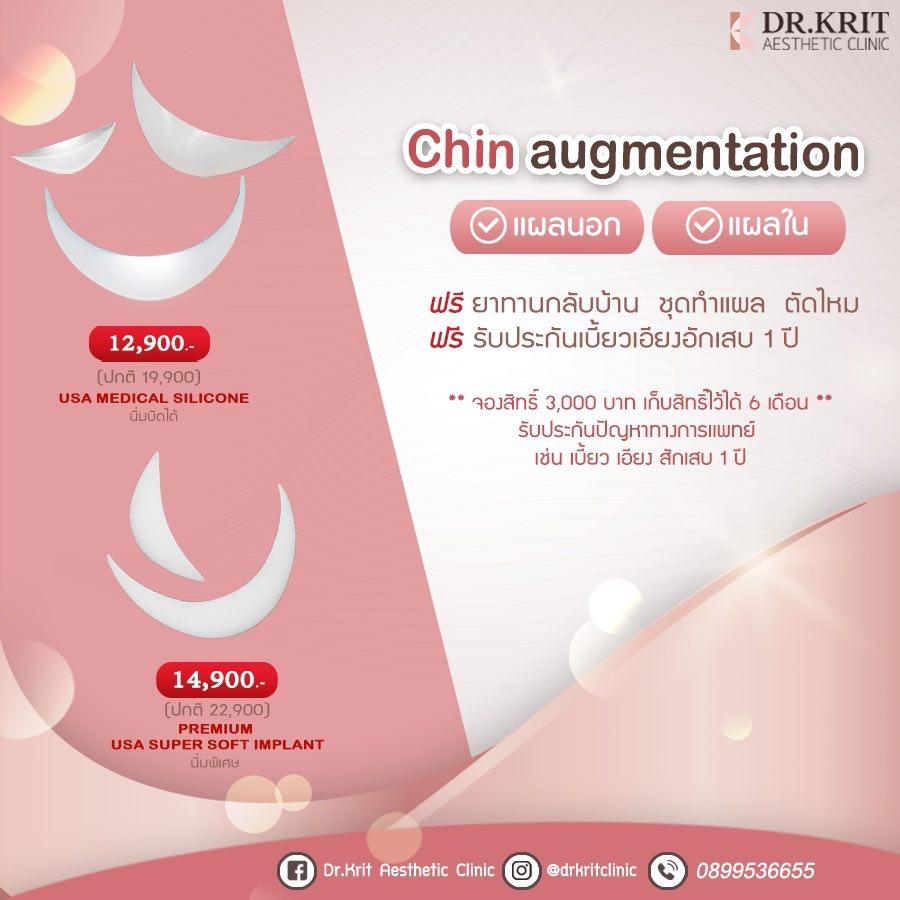 ราคา เสริมคาง ด้วยซิลิโคน เชียงใหม่