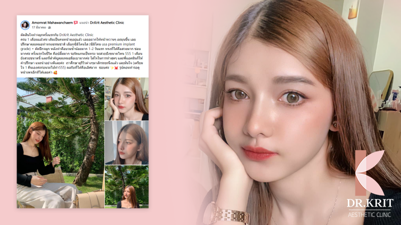 ตัดสินใจทำจมูกครั้งแรกกับ Dr.Krit Aesthetic Clinic