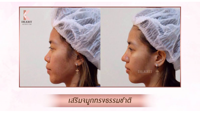 รีวิวรูปภาพ