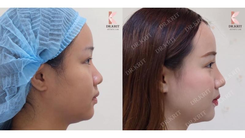 รีวิวรูปภาพ