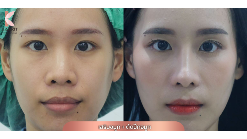 รีวิวรูปภาพ