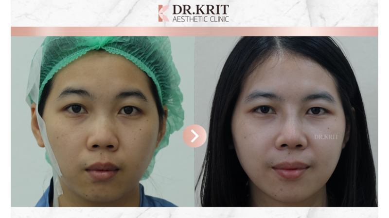 รีวิวรูปภาพ