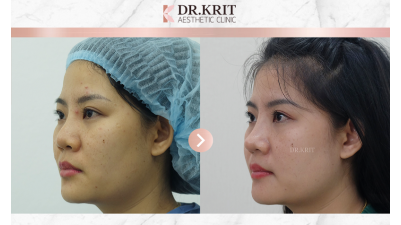 รีวิวรูปภาพ