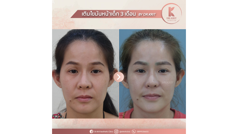 รีวิวรูปภาพ