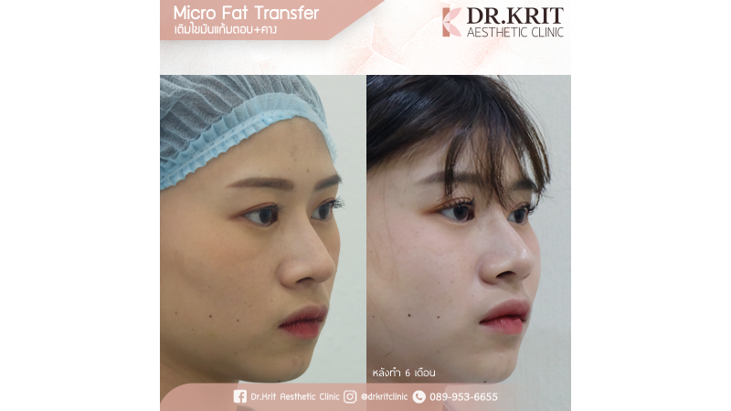 รีวิวรูปภาพ