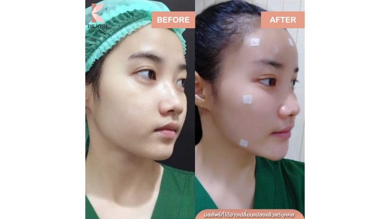 รีวิวรูปภาพ