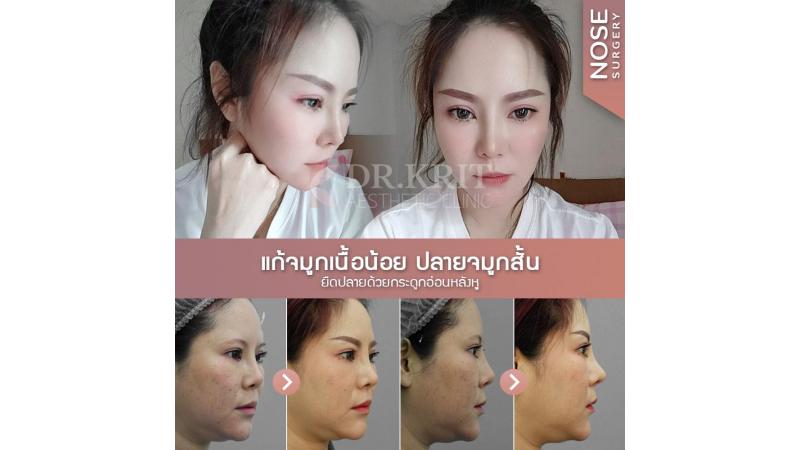 รีวิวรูปภาพ