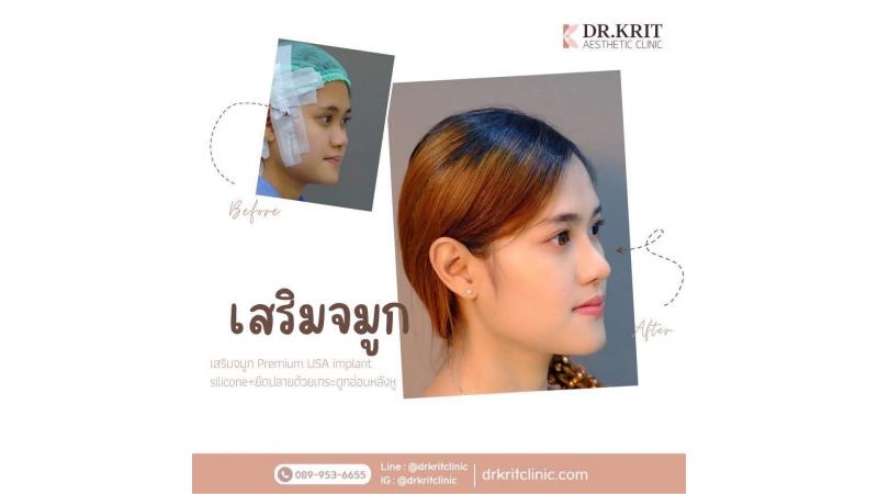 รีวิวรูปภาพ