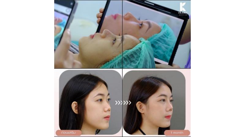 รีวิวรูปภาพ