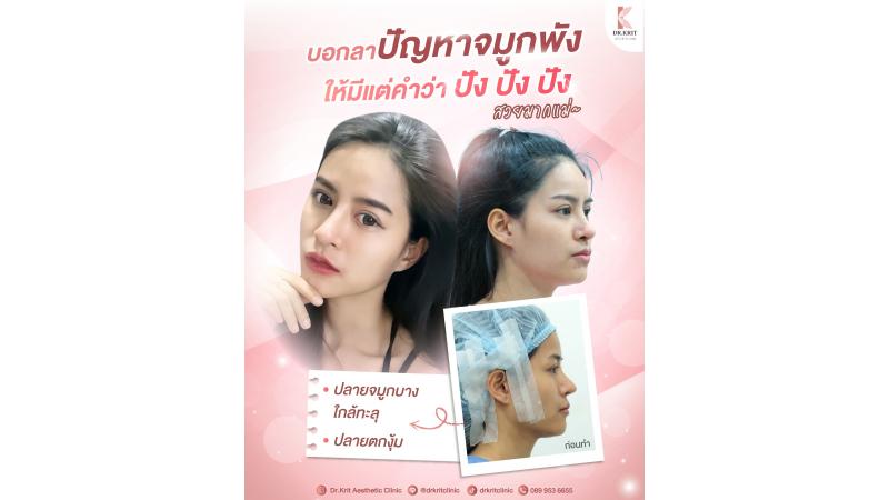 รีวิวรูปภาพ