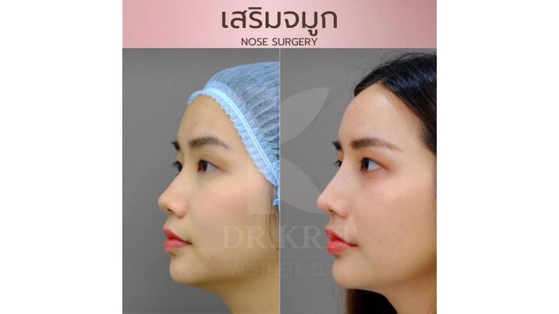 รีวิวรูปภาพ