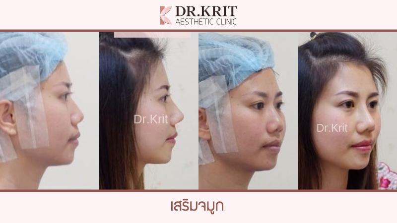 รีวิวรูปภาพ