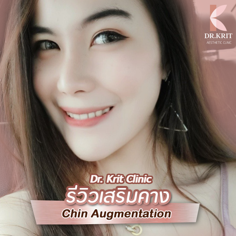 เสริมคางแผลใน และแผลนอก Chin Augmentation