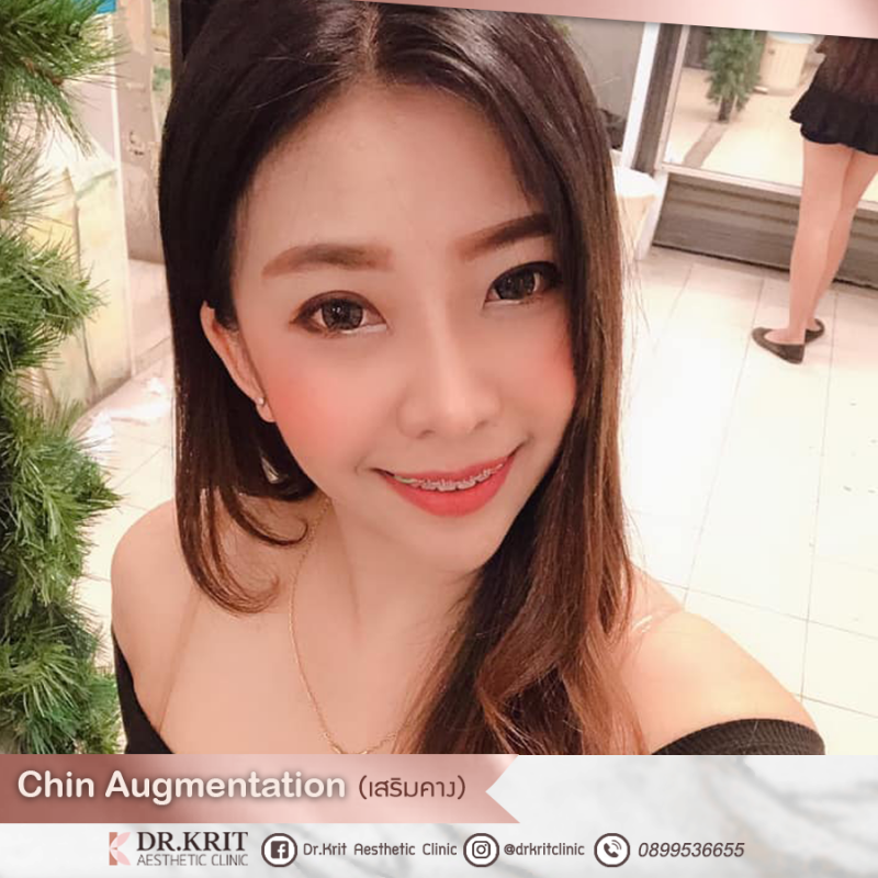 รีวิวรูปภาพ