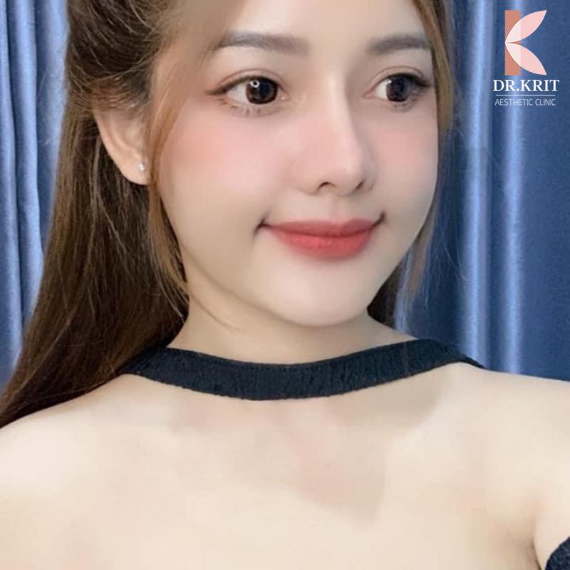 รีวิวรูปภาพ