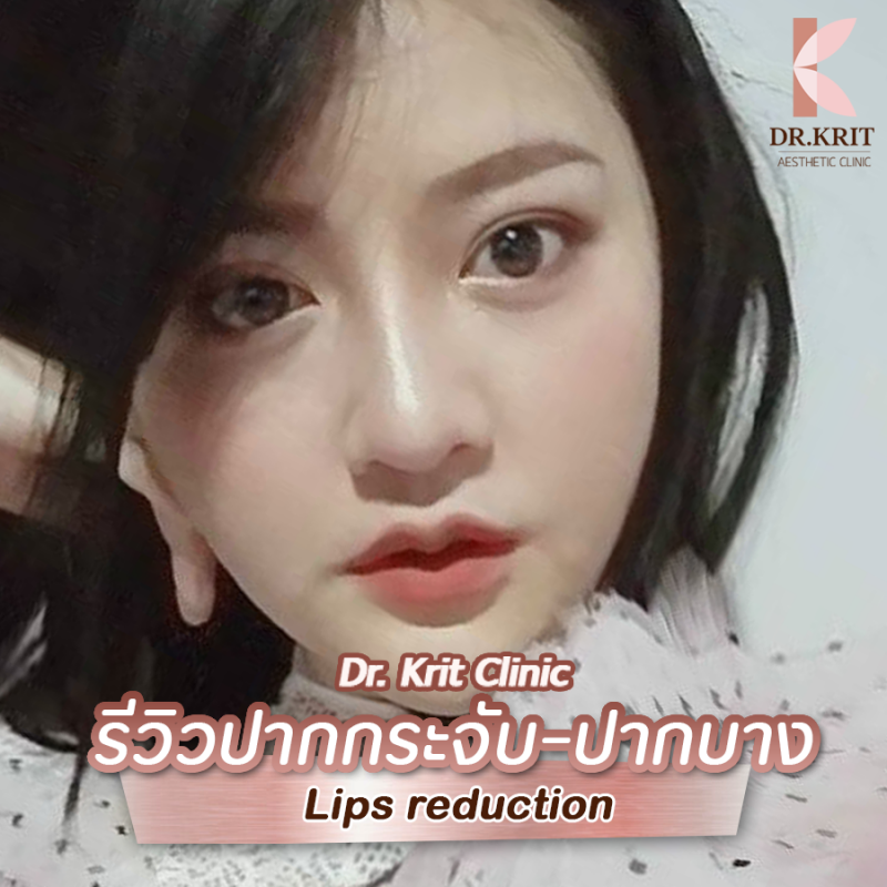 ปากกระจับ ปากบาง Lips Reduction