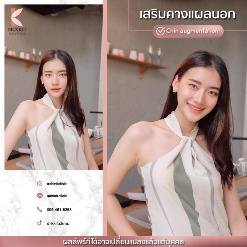 รีวิวรูปภาพ