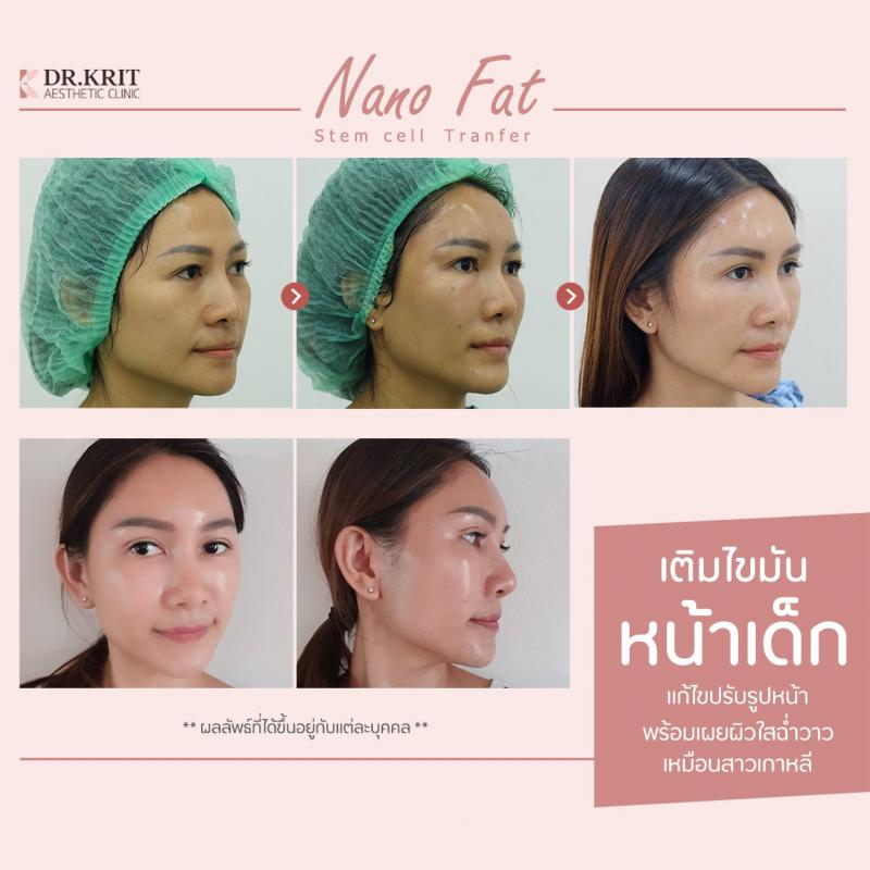 รีวิวรูปภาพ