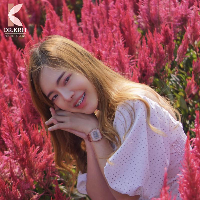 รีวิวรูปภาพ