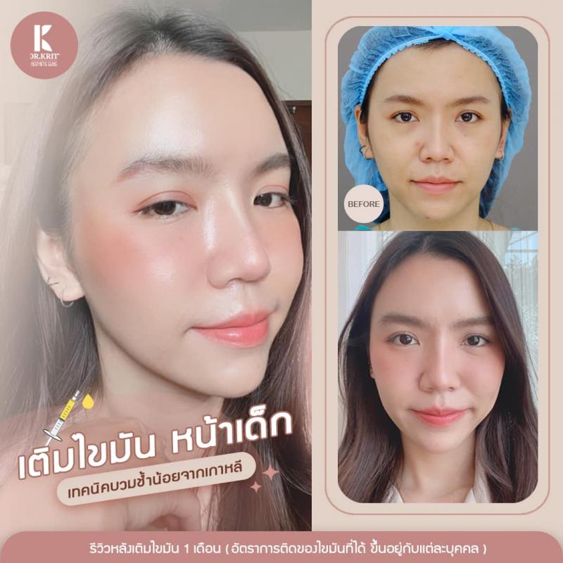 รีวิวรูปภาพ