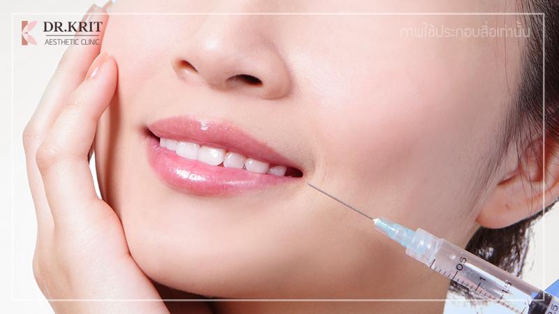 ฟิลเลอร์ (Filler) ฉีดเติมเต็มปาก คาง เชียงใหม่ ด๊อกเตอร์กฤษฏิ์ คลินิก