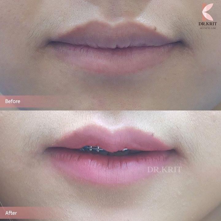 ทำปากบาง ทำปากกระจับ เชียงใหม่