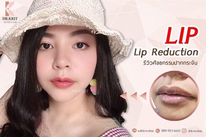 ทำปากบาง ปากกระจับ เชียงใหม่
